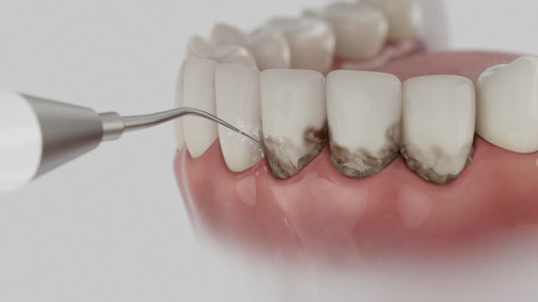 Trusted Teeth Cleaning And Checkup service in Summer Set, MO - Dentist Open Now